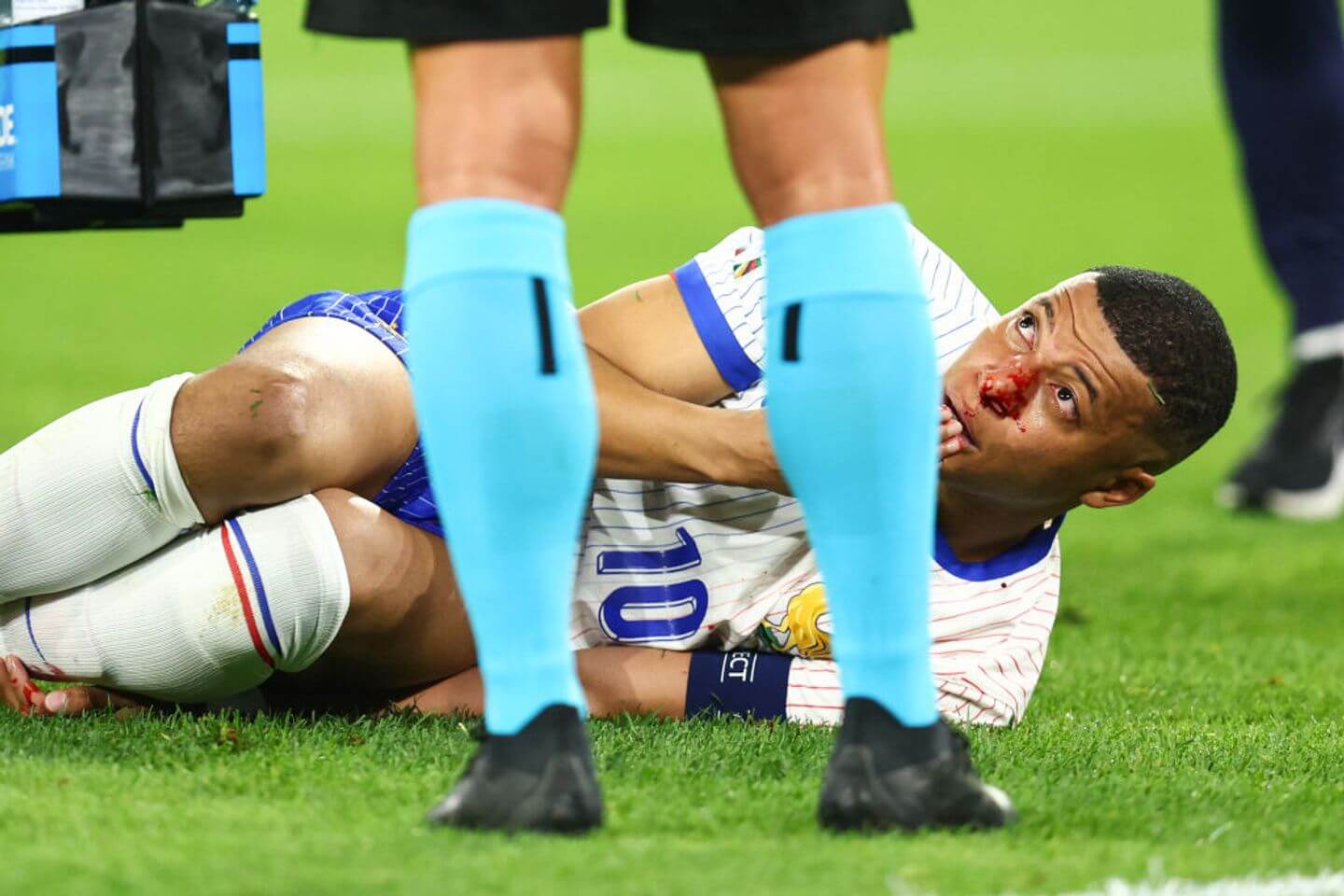 France vs Austria live updates: Kylian Mbappe nose injury sours 1-0 Euro 2024 win for Les Bleus