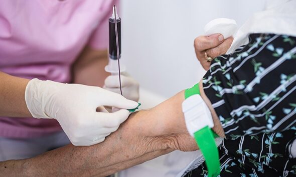 Alzheimer's Blood Test in Primary Care Could Slash Diagnostic Times